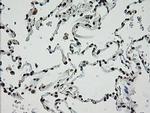 ZNF447 Antibody in Immunohistochemistry (Paraffin) (IHC (P))