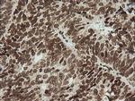 ZNF447 Antibody in Immunohistochemistry (Paraffin) (IHC (P))