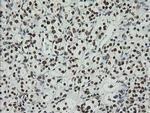 ZNF447 Antibody in Immunohistochemistry (Paraffin) (IHC (P))