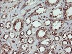 CESK1 Antibody in Immunohistochemistry (Paraffin) (IHC (P))