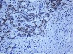 ZNF447 Monoclonal Antibody (OTI2A9)