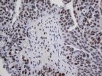 ZNF447 Antibody in Immunohistochemistry (Paraffin) (IHC (P))