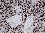 ZNF447 Antibody in Immunohistochemistry (Paraffin) (IHC (P))