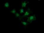 MAGEA4 Monoclonal Antibody (OTI2C1)