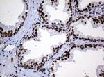 ZNF447 Antibody in Immunohistochemistry (Paraffin) (IHC (P))