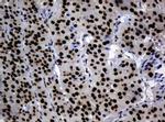 ZNF447 Antibody in Immunohistochemistry (Paraffin) (IHC (P))