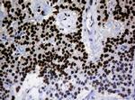 ZNF447 Antibody in Immunohistochemistry (Paraffin) (IHC (P))