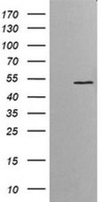 ETS2 Antibody in Western Blot (WB)