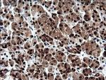 CMPK1 Antibody in Immunohistochemistry (Paraffin) (IHC (P))