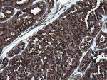 ARMC1 Antibody in Immunohistochemistry (Paraffin) (IHC (P))