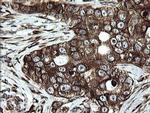ARMC1 Antibody in Immunohistochemistry (Paraffin) (IHC (P))