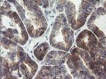 ARMC1 Antibody in Immunohistochemistry (Paraffin) (IHC (P))