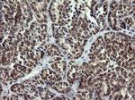 ARMC1 Antibody in Immunohistochemistry (Paraffin) (IHC (P))