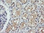 COG6 Antibody in Immunohistochemistry (Paraffin) (IHC (P))