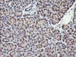 COG6 Antibody in Immunohistochemistry (Paraffin) (IHC (P))