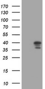 DCPS Antibody in Western Blot (WB)