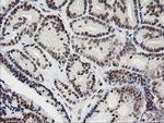 KIF25 Antibody in Immunohistochemistry (Paraffin) (IHC (P))