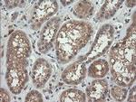 RhoJ Antibody in Immunohistochemistry (Paraffin) (IHC (P))