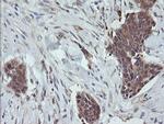 RhoJ Antibody in Immunohistochemistry (Paraffin) (IHC (P))