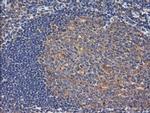 RhoJ Antibody in Immunohistochemistry (Paraffin) (IHC (P))