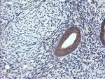 RhoJ Antibody in Immunohistochemistry (Paraffin) (IHC (P))