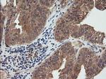 RhoJ Antibody in Immunohistochemistry (Paraffin) (IHC (P))