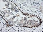 CATIP Antibody in Immunohistochemistry (Paraffin) (IHC (P))