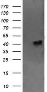 CATIP Antibody in Western Blot (WB)