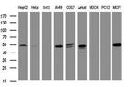 TAPBPL Antibody in Western Blot (WB)