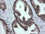 PCDH7 Antibody in Immunohistochemistry (Paraffin) (IHC (P))