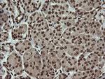 PCDH7 Antibody in Immunohistochemistry (Paraffin) (IHC (P))
