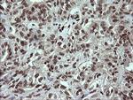 PCDH7 Antibody in Immunohistochemistry (Paraffin) (IHC (P))