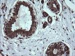 DIXDC1 Antibody in Immunohistochemistry (Paraffin) (IHC (P))