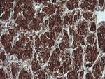 TRIM44 Antibody in Immunohistochemistry (Paraffin) (IHC (P))