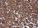 TRIM44 Antibody in Immunohistochemistry (Paraffin) (IHC (P))