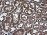 TRIM44 Antibody in Immunohistochemistry (Paraffin) (IHC (P))