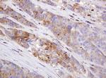 ITFG3 Antibody in Immunohistochemistry (Paraffin) (IHC (P))