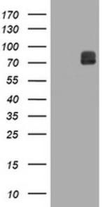 ITFG3 Antibody in Western Blot (WB)