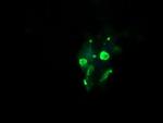 GLB1 Monoclonal Antibody (OTI2F6)