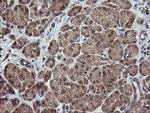 TRAPPC4 Antibody in Immunohistochemistry (Paraffin) (IHC (P))