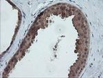 TRAPPC4 Antibody in Immunohistochemistry (Paraffin) (IHC (P))