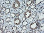 CATIP Antibody in Immunohistochemistry (Paraffin) (IHC (P))