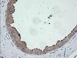 CATIP Antibody in Immunohistochemistry (Paraffin) (IHC (P))