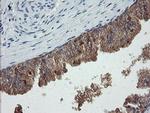 CATIP Antibody in Immunohistochemistry (Paraffin) (IHC (P))