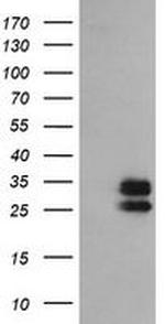 GBAS Antibody in Western Blot (WB)