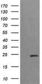 TRAPPC4 Antibody in Western Blot (WB)