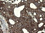 POGK Antibody in Immunohistochemistry (Paraffin) (IHC (P))