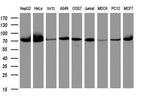 COG6 Antibody in Western Blot (WB)