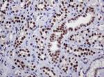 DCPS Antibody in Immunohistochemistry (Paraffin) (IHC (P))