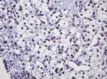 DCPS Antibody in Immunohistochemistry (Paraffin) (IHC (P))
